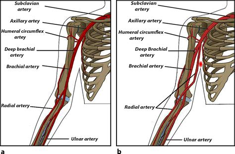 Axillary Artery Cadaver