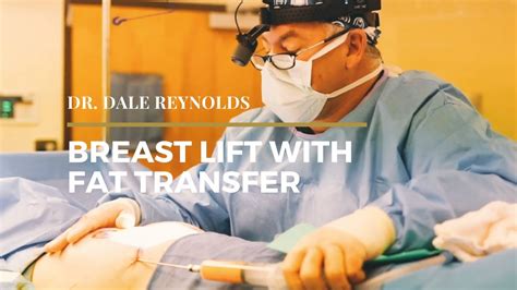 Kuvatulokset haulle breast reconstruction with fat transfer