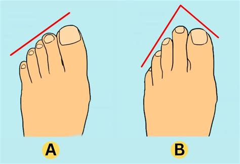 Personality Test: Your Toes Reveal Your Hidden Personality Traits