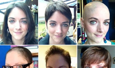 Chemotherapy Patient Before And After