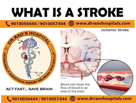 Best Stroke and Cerebrovascular Treatment in Andhra Pradesh