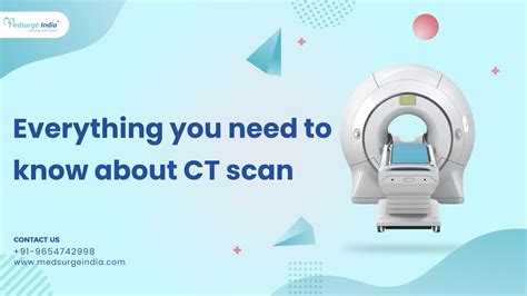 CT Scan 的图像结果