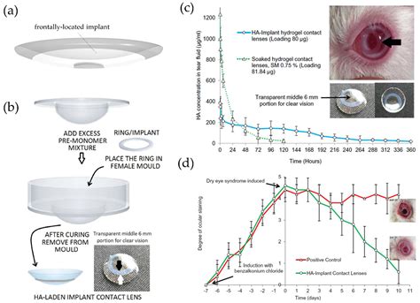Therapeutic Contact Lenses with Polymeric Vehicles for Ocular Drug ...