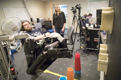 Image result for Bionic Arm Prosthetics