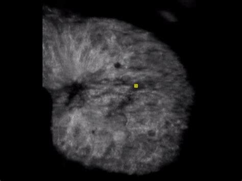 RSNA 2018 - Siemens Healthineers India