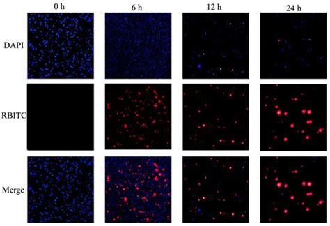 Construction of Chitosan/Alginate Nano-Drug Delivery System for ...