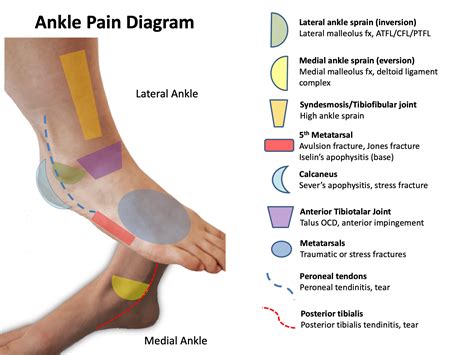 Outer Side Foot Pain Chart - Educational Chart Resources