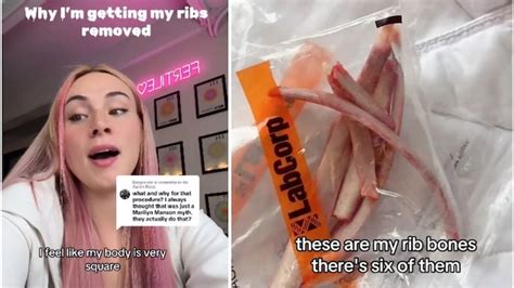 US influencer spends Rs 14 lakh on rib removal - US influencer spends ...