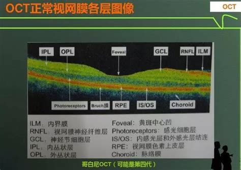 大数据应用 | OCT发展新趋势