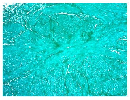 Image result for Unity Fast Green