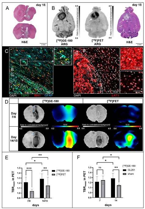 The Traumatic Inoculation Process Affects TSPO Radioligand Uptake in ...