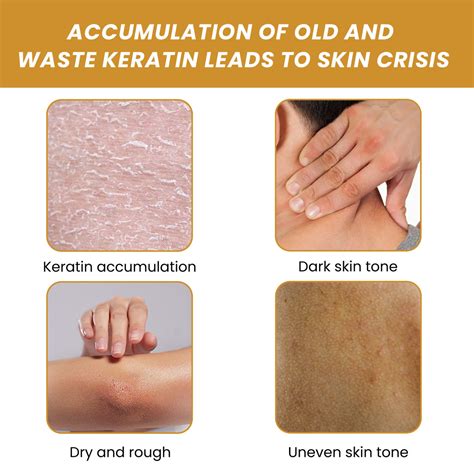 Turmeric Body Scrub Cream, Smallpox Diluting, Moisturizing, Refreshing ...