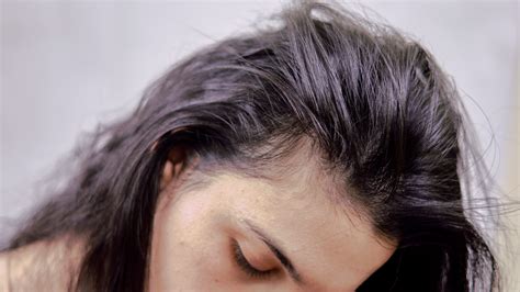 Is Benzophenone-4 Safe for Hair? The Pros and Cons | Clinikally