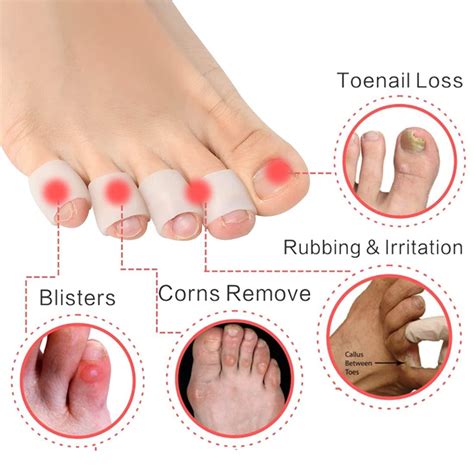 Blister On Pinky Toe