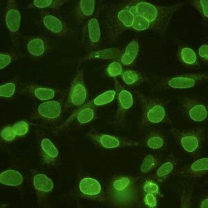 Image result for Ana Pattern Screen