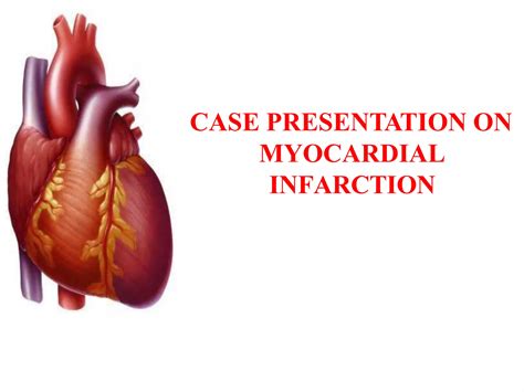 Casepresentation on myocardial infarction | PPTX