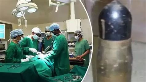 man reached hospital after he get dangerous world war ii explosive ...