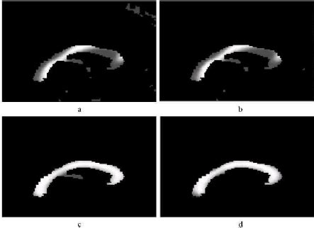 Image result for Iterative Alignment Blade