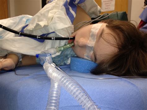 Pediatric Anesthesia 的图像结果