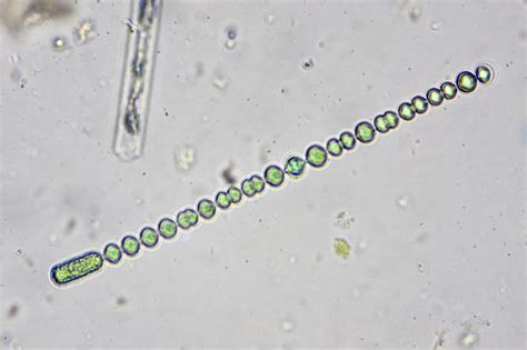 Anabaena 40x