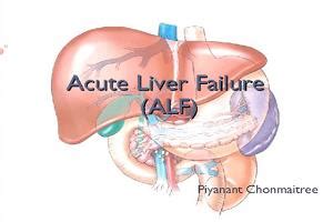Liver Transplant Surgeon in Nagpur , Liver Transplant Surgeon, Liver ...