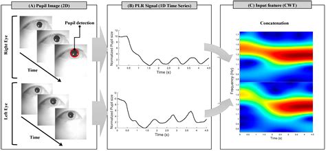 Hybrid BCI for Meal-Assist Robot Using Dry-Type EEG and Pupillary Light ...
