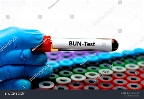 Blood Sample Tube Blood Urea Nitrogen Stock Photo 2548506415 | Shutterstock