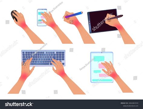 Vector Illustration Set Hands Carpal Tunnel Stock Vector (Royalty Free) 2261067233 | Shutterstock
