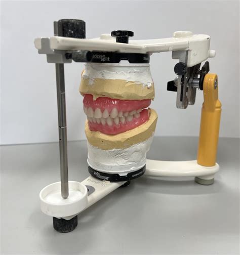 Image result for Immediate Dentures Procedure