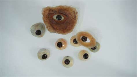 Customized Artificial Eye in Hyderabad | Reform vision