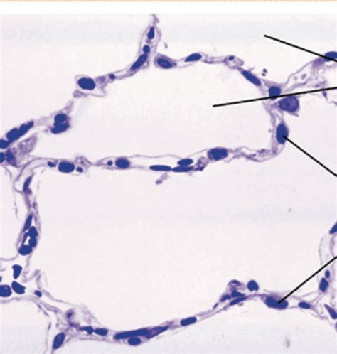 Image result for Ephilehal Tissue Sample