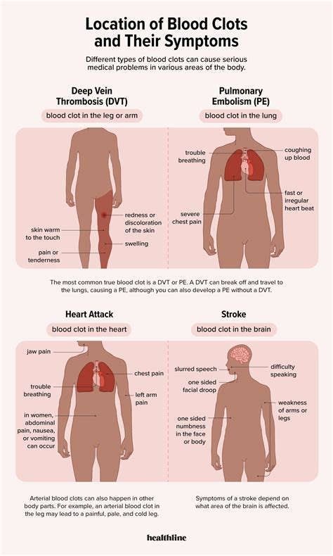 Period Blood Clots Types
