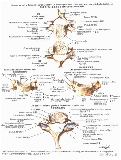 Image result for Vertebrae Alignment