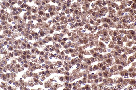 IHCeasy COG7 Ready-To-Use IHC Kit KHC2371 | Proteintech