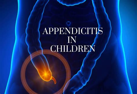 Clinical Manifestations of Appendicitis in Children – The Operating Room Global (TORG)