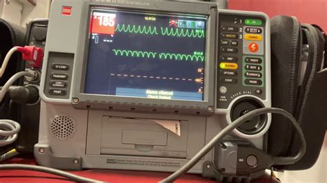 Image result for Synchronized Cardioversion Machine