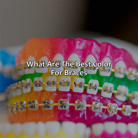 Braces Colors That Go With Everything at Jayson Browne blog