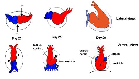 Image result for Heart Development Disorders