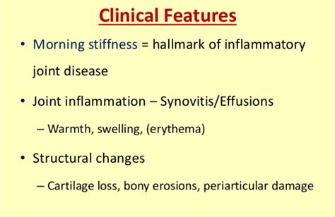 Clinical features of Rheumatoid Arthritis | Joint inflammation ...