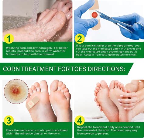 Seed Corn Foot Removal