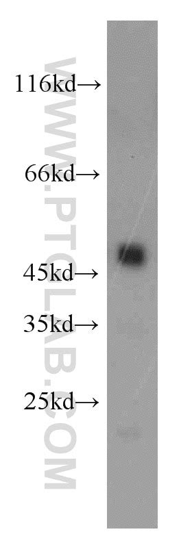 CPB1 antibody (12600-1-AP) | Proteintech