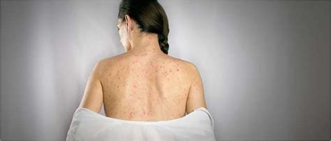 List of All Diseases & Condition in One Place | Truemeds