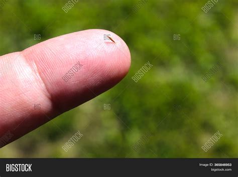 Splinter Finger 的图像结果