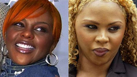 Plastic Surgery Disasters 的图像结果