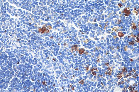 Foxp3 antibody (65089-1-Ig) | Proteintech