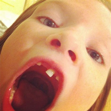 Image result for First Loose Tooth Getting Pulled Out