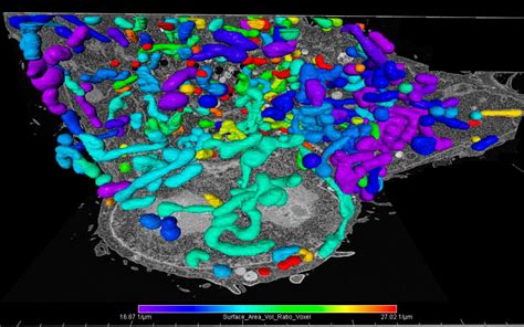 AI Image Analysis for Volume Electron Microscopy | ZEISS