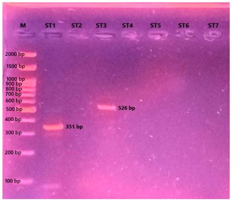 Antiprotozoal Effects of Pediococcus acidilactici-Derived Postbiotic on ...