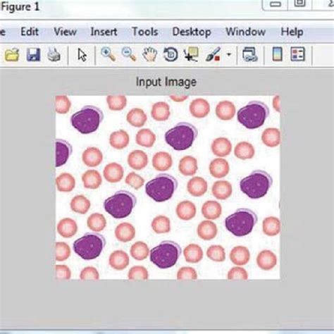 Image result for WBC Count Microscope