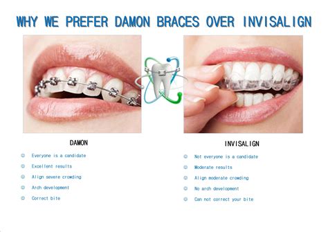 Braces Vs Brackets Arrays at Carroll Zabala blog